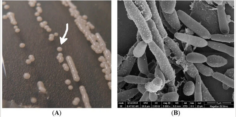 Candida-parapsilosis-An-Overview.png
