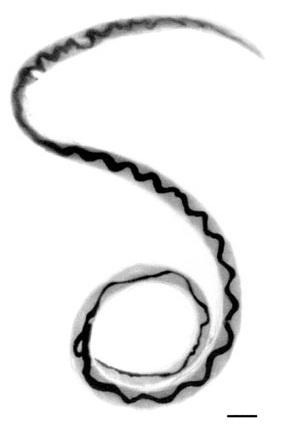 Angiostrongylus cantonensis.jpg