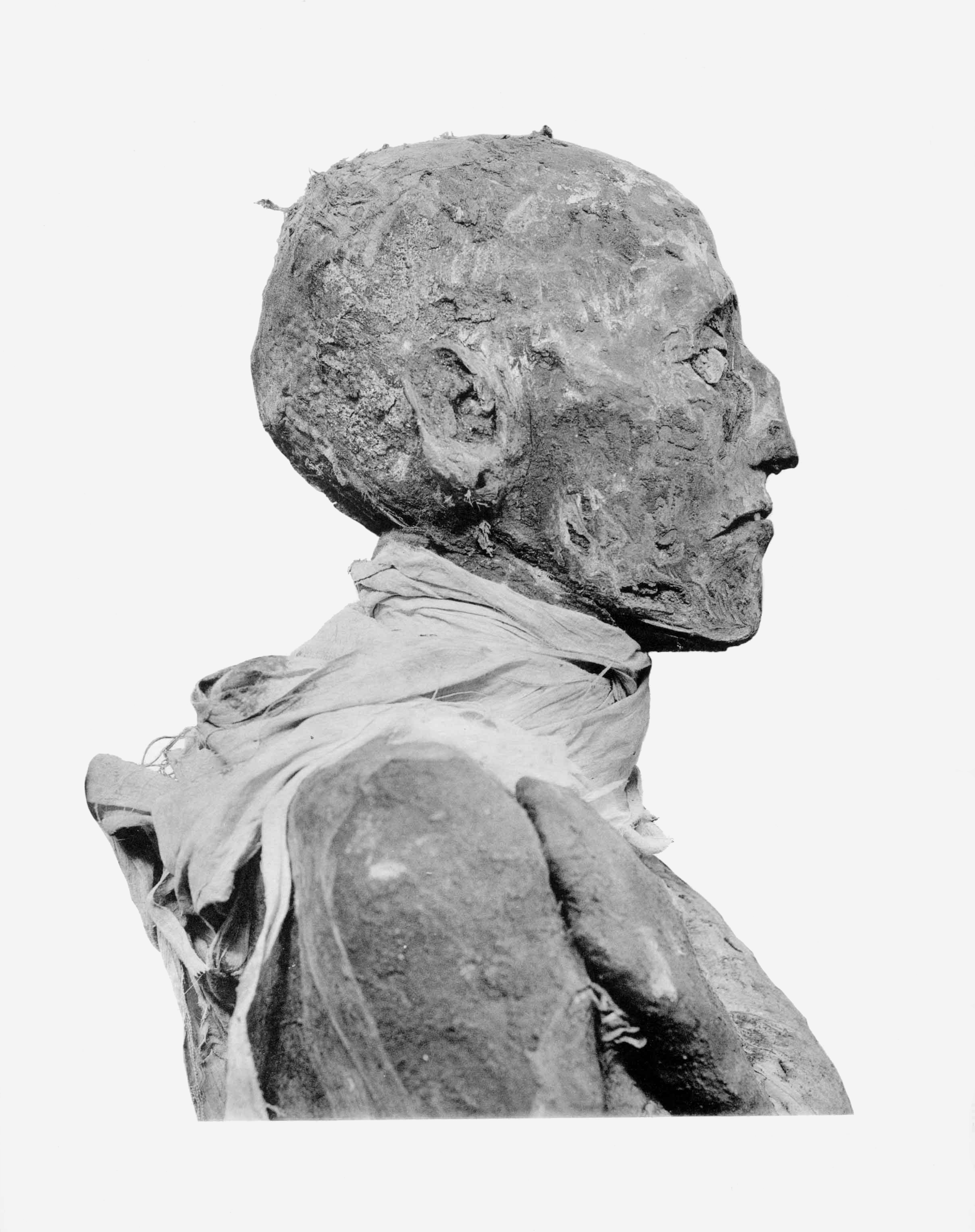 Ramses III mummy head profile.png