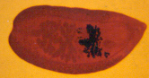 Artyfechinostomum malayanum.jpg