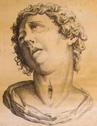 Файл:Tracheotomy1.jpg
