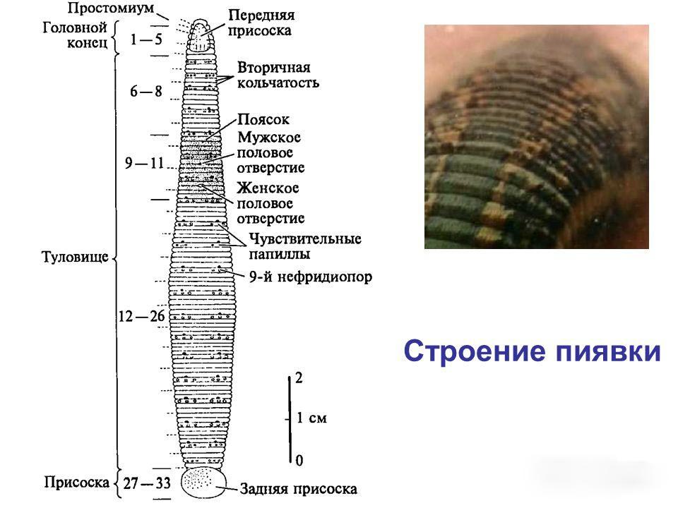 Hirudinea 2.jpg