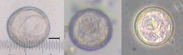Eggs of tapeworm Bertiella studeri.jpg